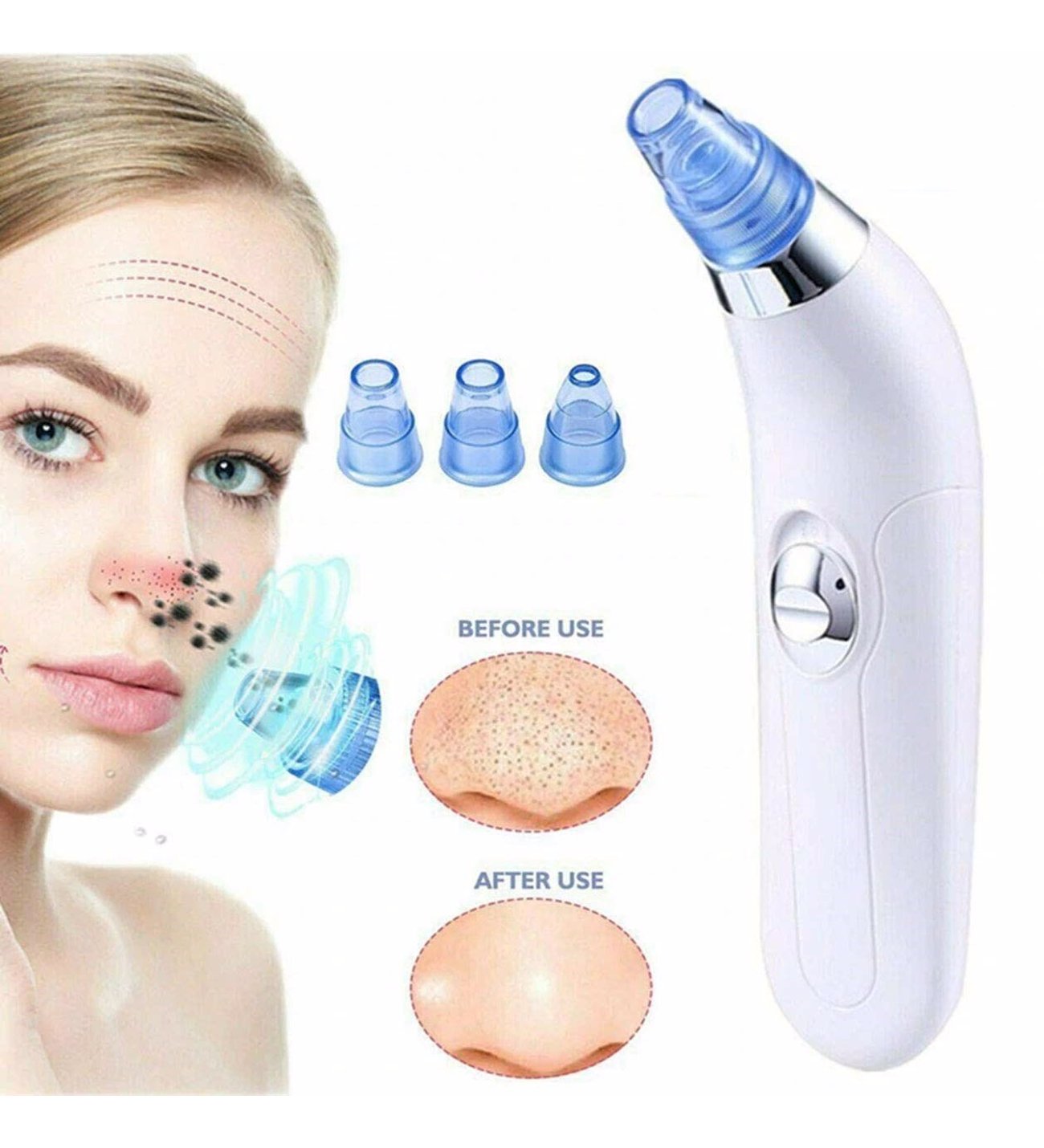 DERMA SUCTION 4 IN 1 BLACK HEAD REMOVER